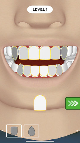 镶个金牙 1.1.0 安卓版