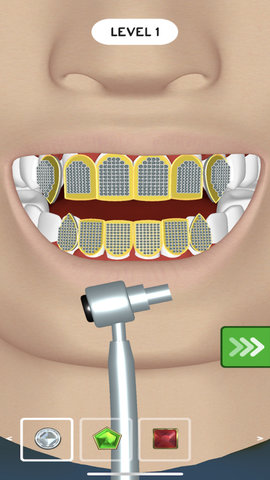 镶个金牙 1.1.0 安卓版