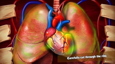 模拟心脏手术游戏 1.0 安卓版