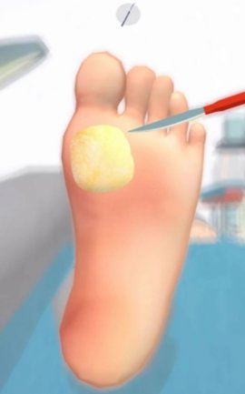 重口味修脚高手模拟器 1.0 安卓版