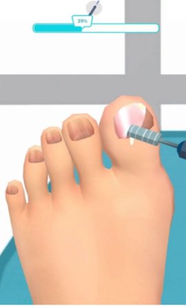 重口味修脚高手模拟器 1.0 安卓版