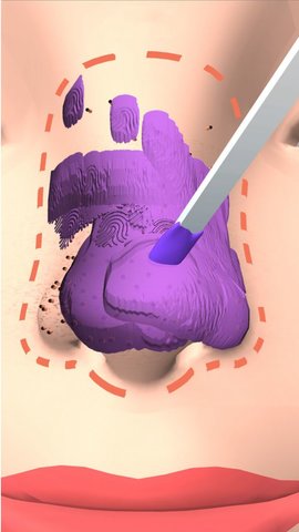 挤黑头大师 0.2 安卓版