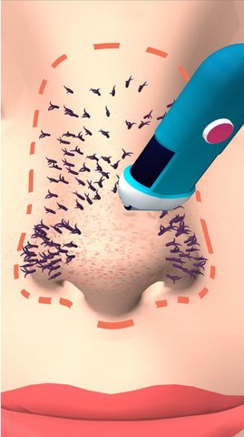 挤黑头大师 0.2 安卓版