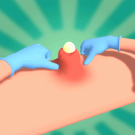 粉刺挤压（Pimple Squeeze） v1.1 安卓版