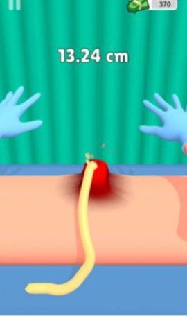 粉刺挤压(Pimple Squeeze) v1.1 安卓版