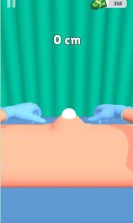 粉刺挤压(Pimple Squeeze) v1.1 安卓版